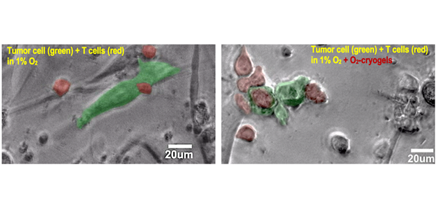Microscopy images depicting the ability of O2-cryogels to restore OT-1 (red, T cells) cytotoxic activity and kill B16-OVA tumor cells (green) under immunosuppressive hypoxic conditions (~1% O2).